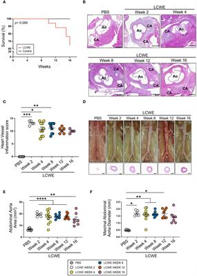 Long-term cardiovascular inflammation and fibrosis in a murine model of vasculitis induced by Lactobacillus casei cell wall extract